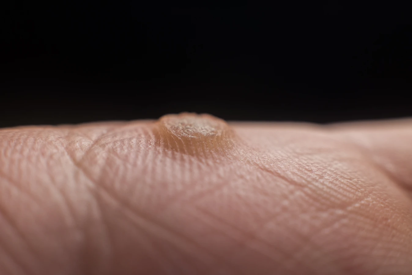  Podologia nauką o stopach